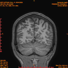 2025-06-14/COR_MPR/0192-IM537.png