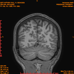 2025-06-14/COR_MPR/0193-IM538.png
