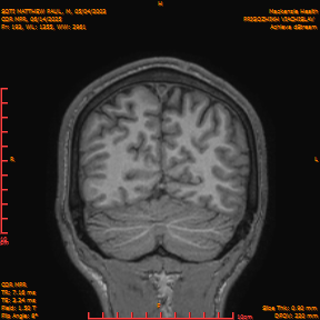 2025-06-14/COR_MPR/0194-IM539.png