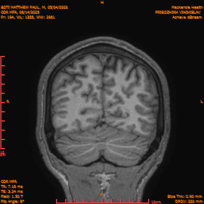 2025-06-14/COR_MPR/0195-IM540.png
