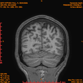 2025-06-14/COR_MPR/0196-IM541.png