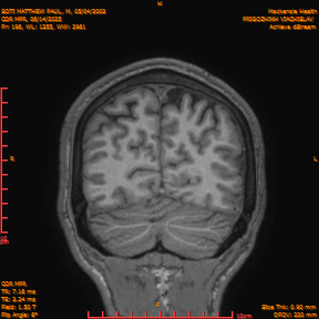 2025-06-14/COR_MPR/0197-IM542.png