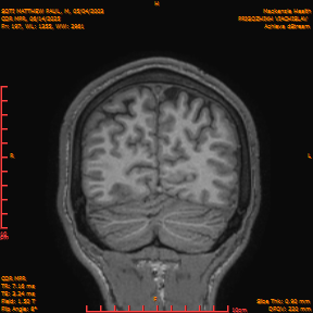 2025-06-14/COR_MPR/0198-IM543.png