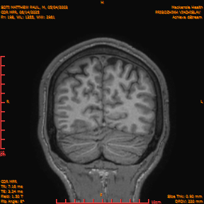 2025-06-14/COR_MPR/0199-IM544.png