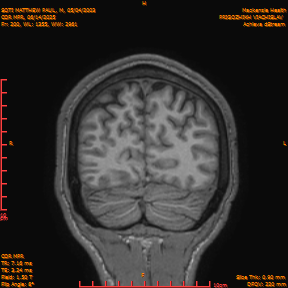 2025-06-14/COR_MPR/0201-IM546.png