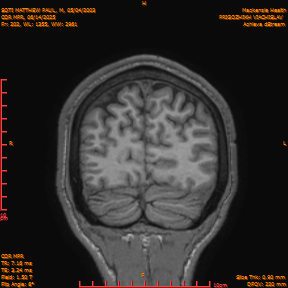 2025-06-14/COR_MPR/0203-IM548.png