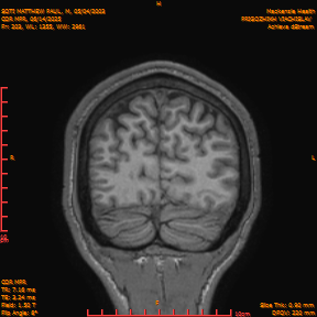 2025-06-14/COR_MPR/0204-IM549.png
