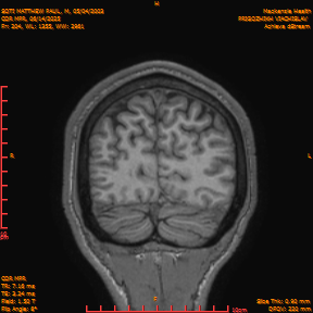 2025-06-14/COR_MPR/0205-IM550.png