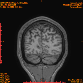 2025-06-14/COR_MPR/0207-IM552.png