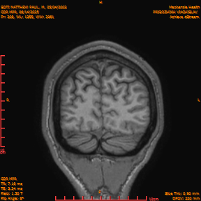 2025-06-14/COR_MPR/0209-IM554.png