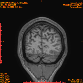 2025-06-14/COR_MPR/0210-IM555.png