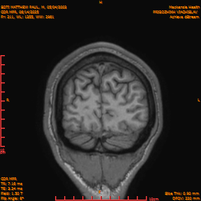 2025-06-14/COR_MPR/0212-IM557.png