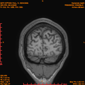 2025-06-14/COR_MPR/0213-IM558.png