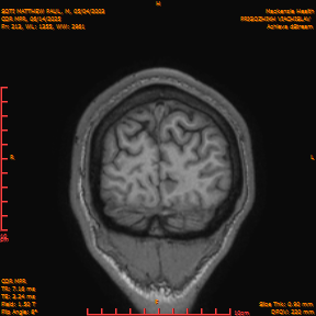 2025-06-14/COR_MPR/0214-IM559.png