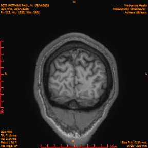 2025-06-14/COR_MPR/0216-IM561.png