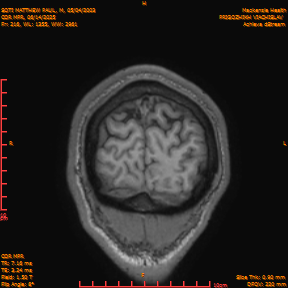 2025-06-14/COR_MPR/0217-IM562.png