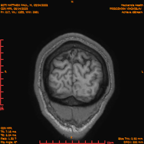 2025-06-14/COR_MPR/0218-IM563.png