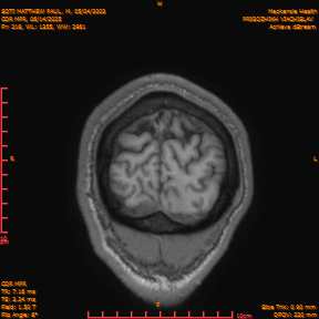 2025-06-14/COR_MPR/0219-IM564.png