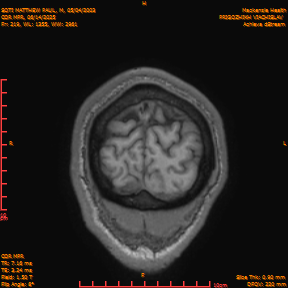 2025-06-14/COR_MPR/0220-IM565.png