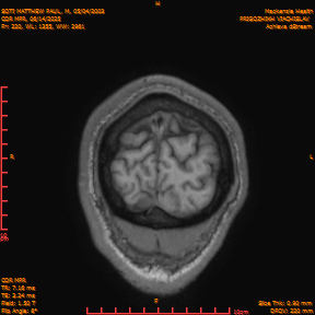 2025-06-14/COR_MPR/0221-IM566.png