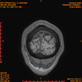 2025-06-14/COR_MPR/0223-IM568.png