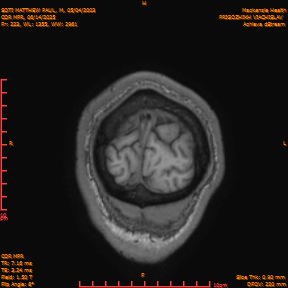 2025-06-14/COR_MPR/0224-IM569.png