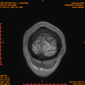 2025-06-14/COR_MPR/0225-IM570.png