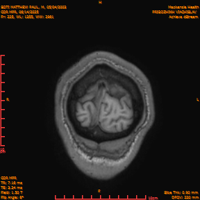 2025-06-14/COR_MPR/0226-IM571.png