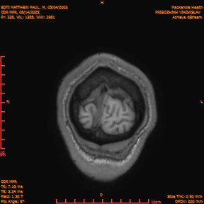 2025-06-14/COR_MPR/0227-IM572.png