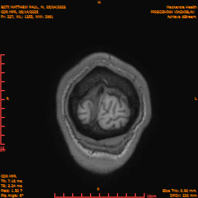 2025-06-14/COR_MPR/0228-IM573.png