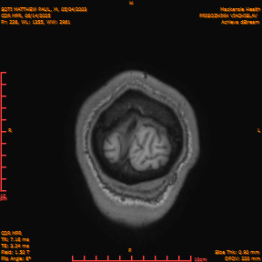 2025-06-14/COR_MPR/0229-IM574.png