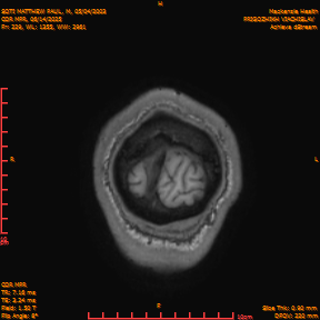 2025-06-14/COR_MPR/0230-IM575.png