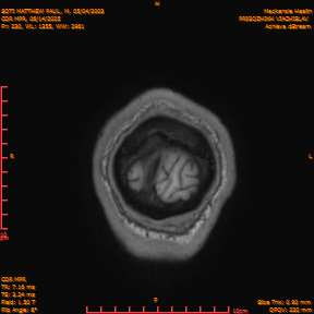 2025-06-14/COR_MPR/0231-IM576.png