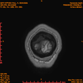 2025-06-14/COR_MPR/0232-IM577.png