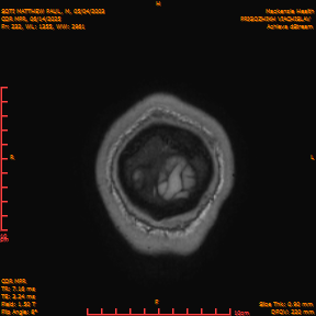 2025-06-14/COR_MPR/0233-IM578.png