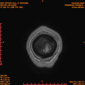 2025-06-14/COR_MPR/0234-IM579.png