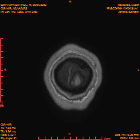 2025-06-14/COR_MPR/0235-IM580.png