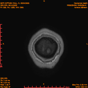 2025-06-14/COR_MPR/0236-IM581.png