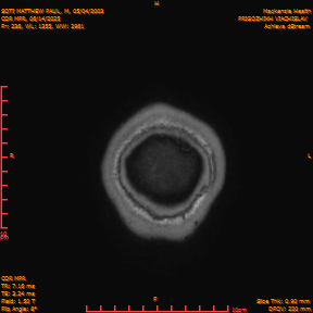 2025-06-14/COR_MPR/0237-IM582.png