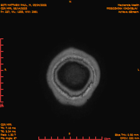 2025-06-14/COR_MPR/0238-IM583.png