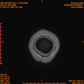 2025-06-14/COR_MPR/0239-IM584.png