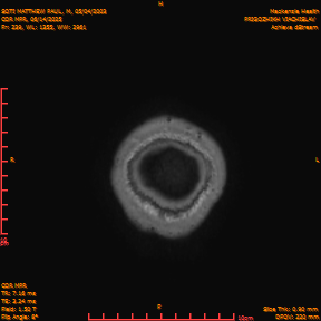 2025-06-14/COR_MPR/0240-IM585.png