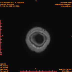 2025-06-14/COR_MPR/0241-IM587.png