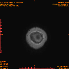 2025-06-14/COR_MPR/0243-IM588.png