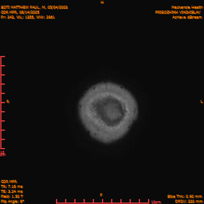 2025-06-14/COR_MPR/0244-IM589.png