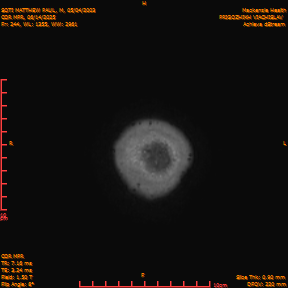 2025-06-14/COR_MPR/0245-IM590.png
