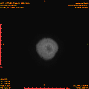 2025-06-14/COR_MPR/0246-IM591.png