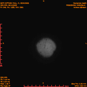 2025-06-14/COR_MPR/0247-IM592.png