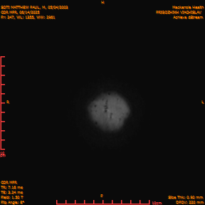 2025-06-14/COR_MPR/0248-IM593.png