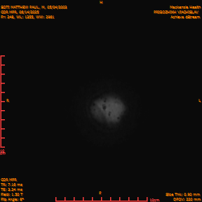 2025-06-14/COR_MPR/0249-IM594.png